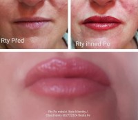 /album/fotogalerie/rty-2022-jpg11-jpg/